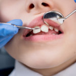 ortodoncia infantil