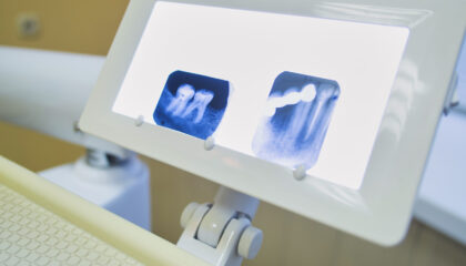 son seguras las radiografías dentales